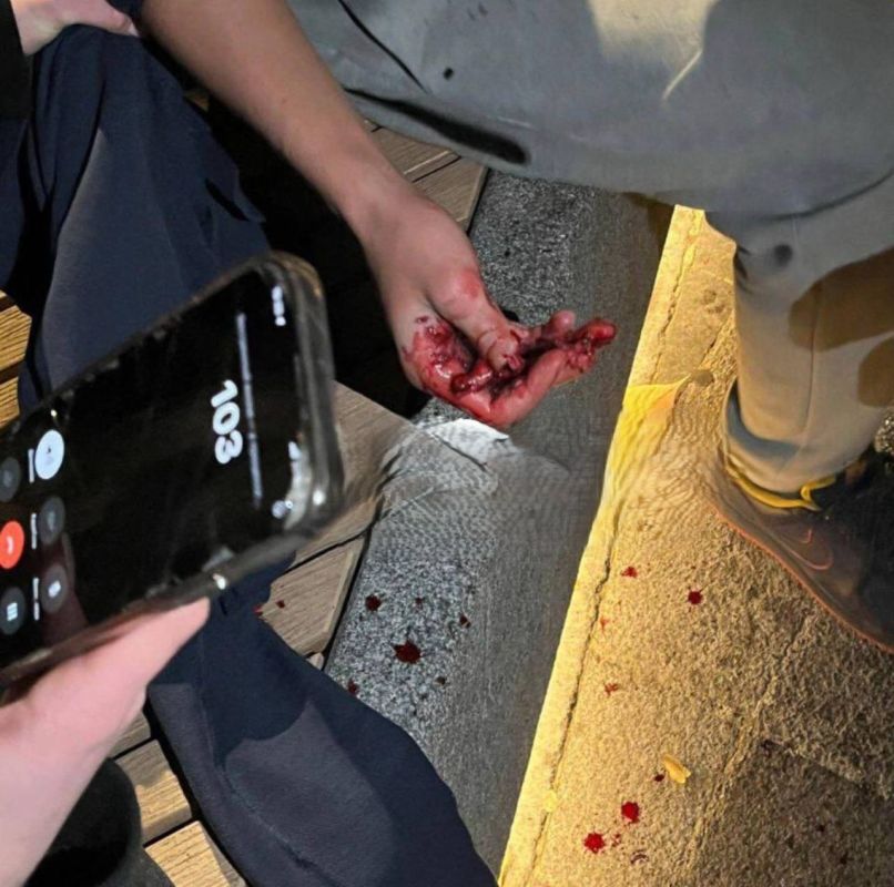 На Успенской площади парню оторвало палец из-за взрыва страйкбольной гранаты