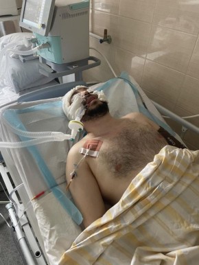 Житель Днепропетровска впал в кому после нападения душегубов ТЦК в балаклавах